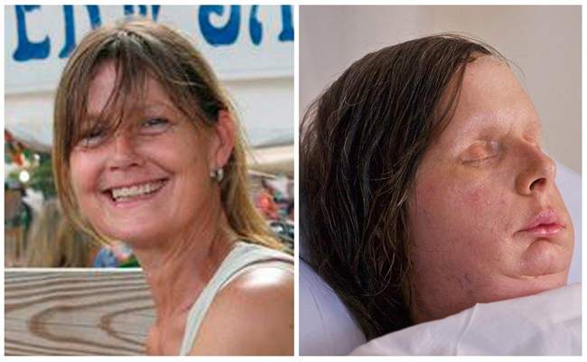 Undated photos provided Thursday, Aug. 11, 2011 by the Nash family and Brigham and Women’s Hospital show chimpanzee attack victim Charla Nash before she was attacked by a chimpanzee and a recent photo released by the hospital showing Nash after face transplant surgery, right. (AP Photo/Brigham and Women’s Hospital, Lightchaser Photography)