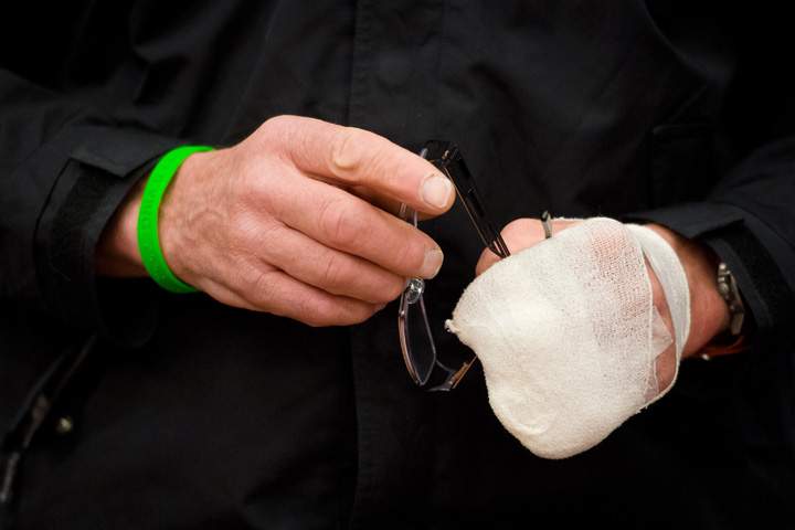 Frostbite bandage