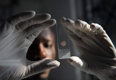 Genetic testing prompts new style of preventive health care - image