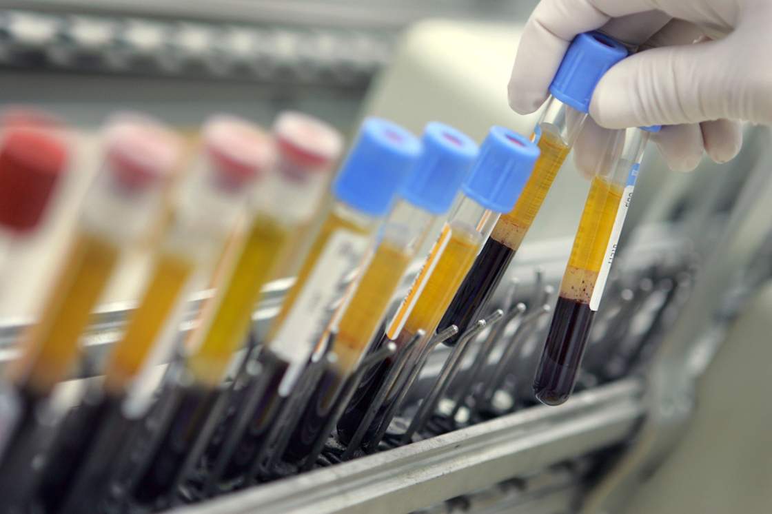 A laboratory technician places human blood samples on an automated testing line at the Maccabi Health Services HMO central testing laboratory January 22, 2006 in Nes Tsiona which is located in central Israel.