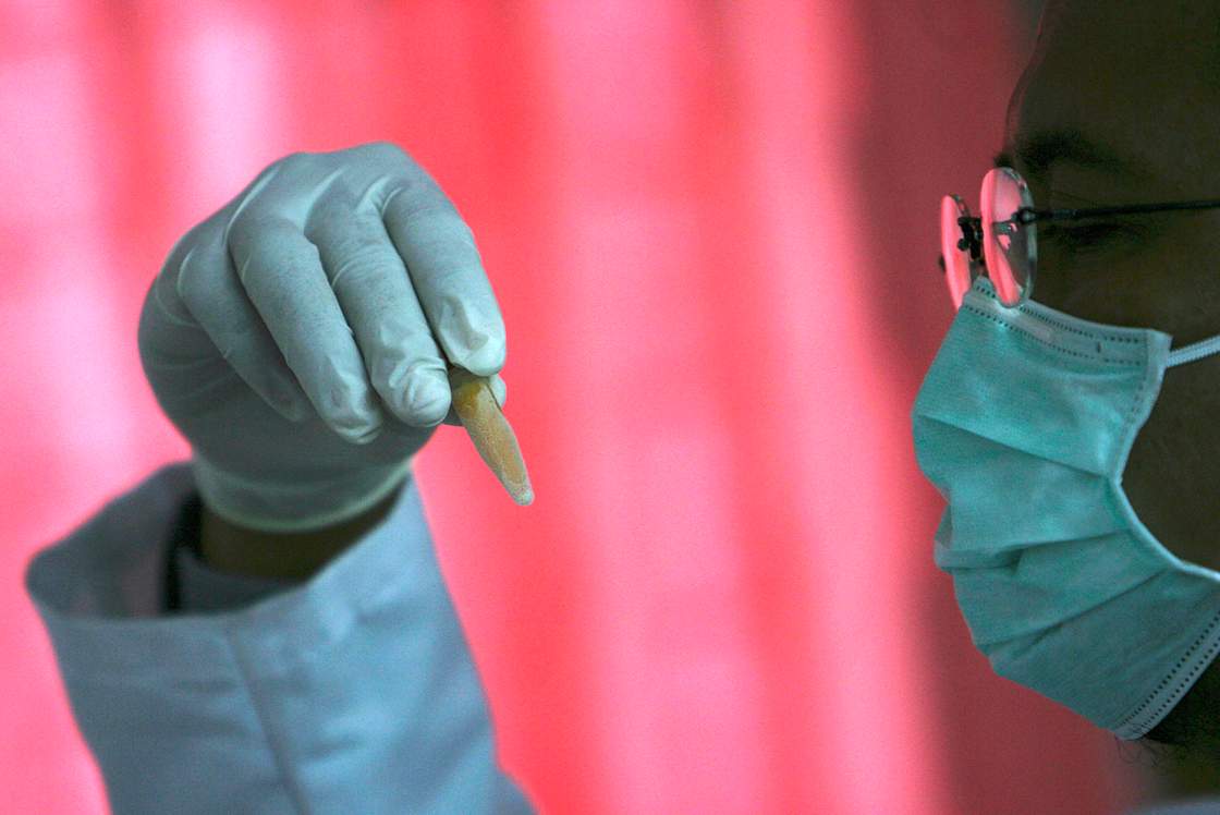 Chairul Anwar Nidom (2nd R), a scientist from Airlangga University Surabaya, looks at a viral sample of H5N1 from a chicken in a lab February 28, 2007.