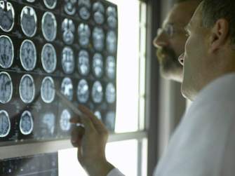 On Monday, Grand Challenges Canada poured $10.9 million in seed money funding to 102 ideas scientists are working on in health care innovation.