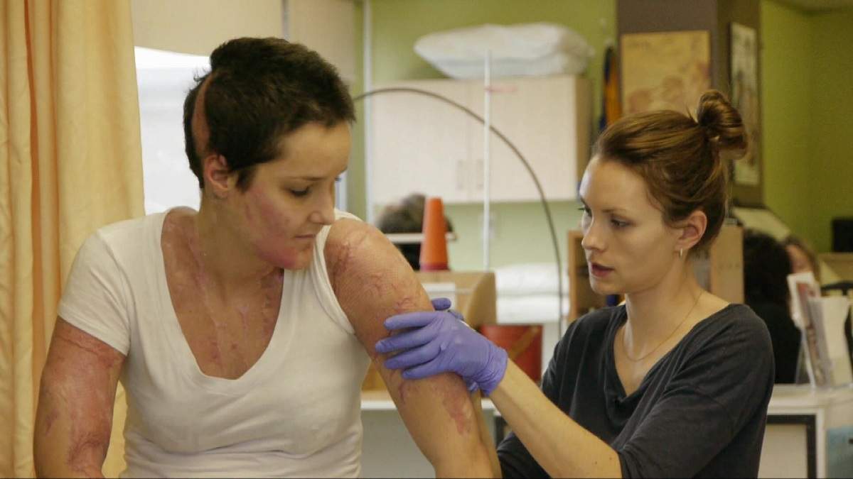 Tanya St. Arnauld suffered third degree burns to 20 per cent of her body.
