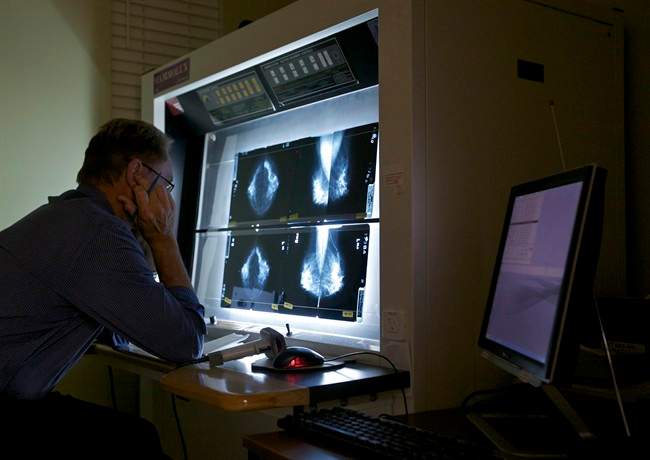 mammogram computer doctor