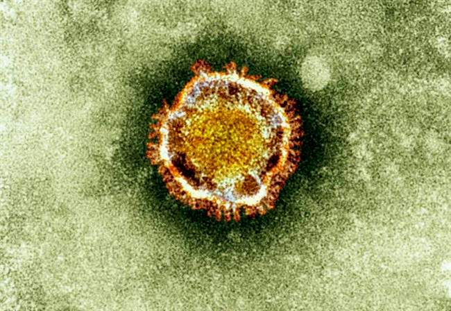 FILE - In this undated file image released by the British Health Protection Agency shows an electron microscope image of a coronavirus, part of a family of viruses that cause ailments including the common cold and SARS, which was first identified last year in the Middle East. 