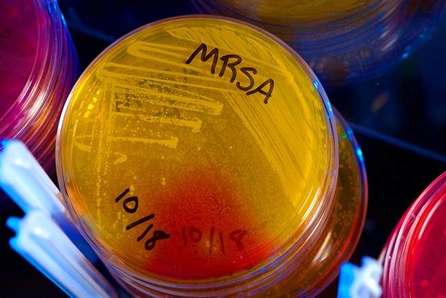 MRSA