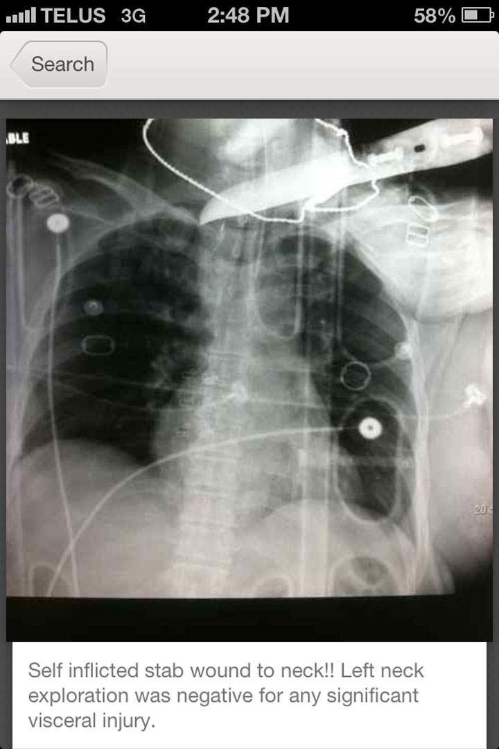 "Self inflicted stab wound to the neck," writes one user on the Figure 1 photo-sharing app. Doctors can use the app to upload an archived photo with an explanation of diagnosis and condition, or even upload a photo on the spot to help diagnosis.