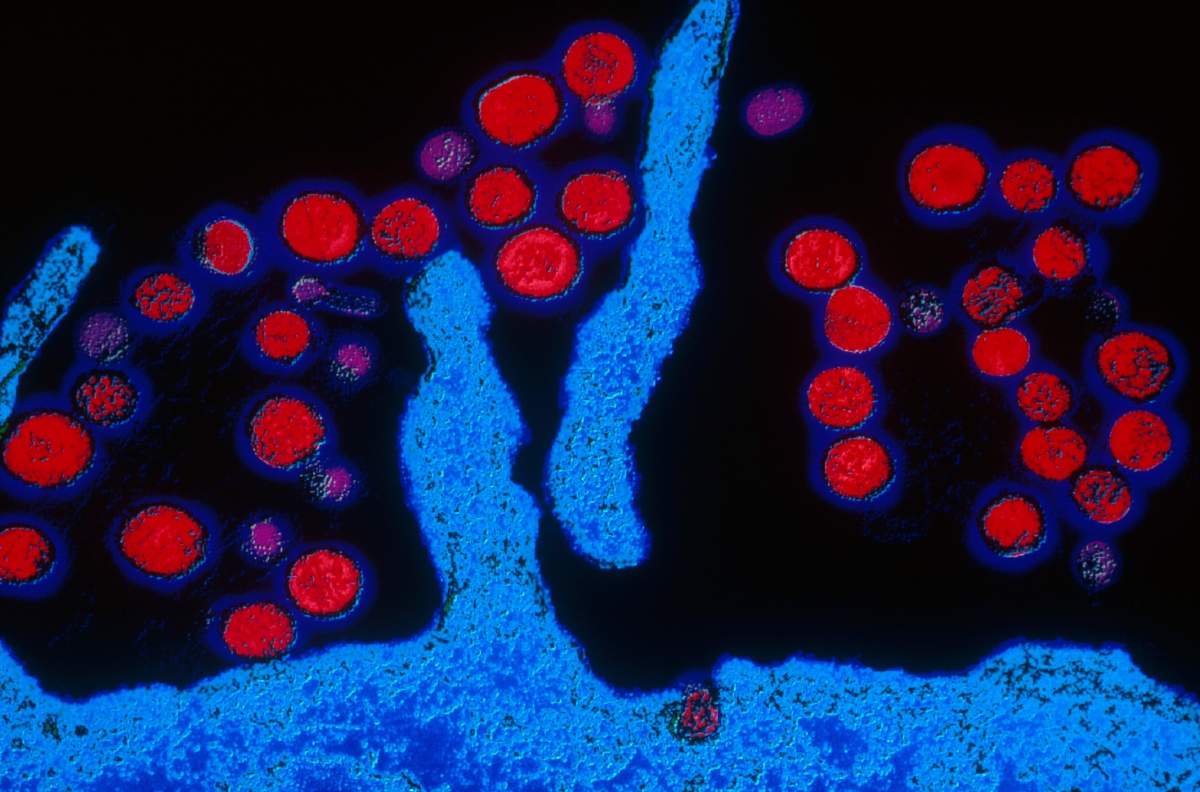 This color enhanced Transmission Electron Micrograph (TEM) shows hantaviruses, agents of hemorrhagic fever, budding from the surface of a kidney cell.