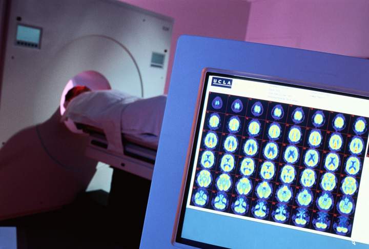 University of Saskatchewan approves building cyclotron to make medical isotopes.