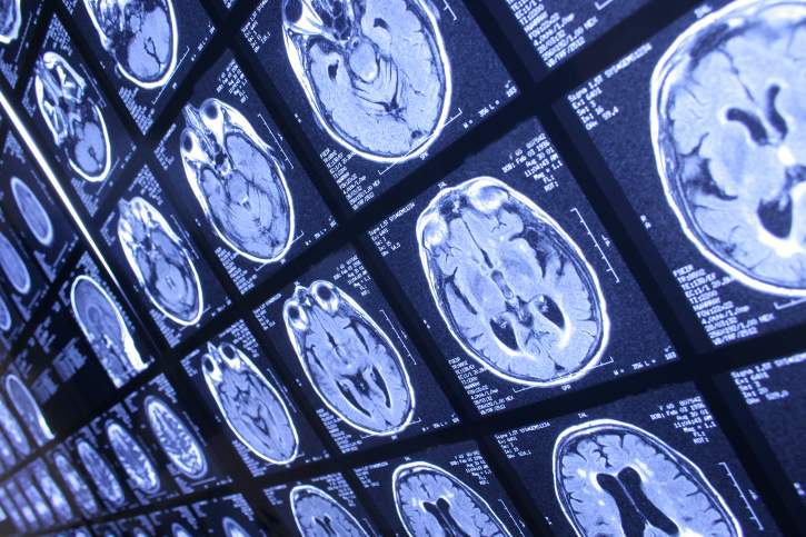 The Saskatoon Health Region says diagnostic images of 206 patients, including CT scans and X-rays have been lost in archives.