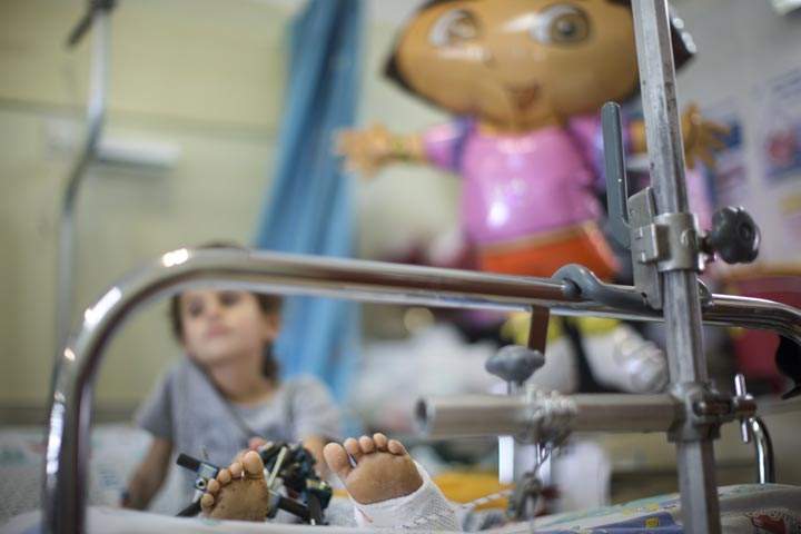 A wounded Syrian child is treated at the Israeli Ziv hospital on August 28, 2013 in the northern town of Safed, Israel. 