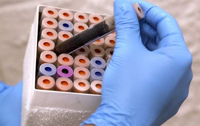 In this image provided by Duke University, lab research analyst Marshall Nichols does research relating to a new blood test on Tuesday, Sept. 17, 2013, in Durham, N.C. 