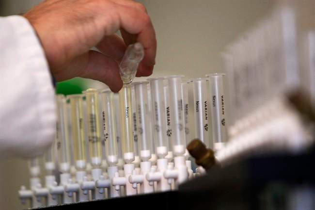 FILE - In this Feb. 5, 2010 file photo, a laboratory technician prepares samples of urine for doping tests during a media open day, at the King's College London Drug Control Centre, London.