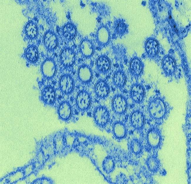 An digitally colored image of the H1N1 flu virus is shown in a handout photo. A new study suggests the number of people who died from H1N1 pandemic flu in 2009 was similar to the annual toll taken by seasonal flu.THE CANADIAN PRESS/HO- Centers for Disease Control/Cynthia Goldsmith.