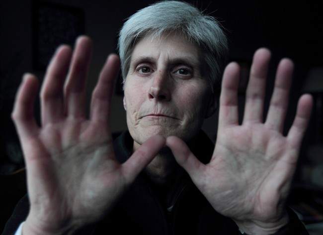 Michelle Richard holds up her hands at her home in Halifax on Thursday, Nov. 14, 2013.