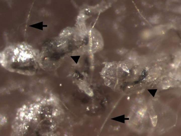 Hair shafts (arrows) formed by induced stem cell-derived epithelial stem cells. (Supplied photo)