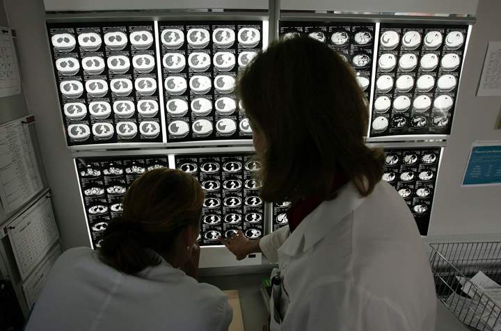 Ottawa doctors say they've uncovered groundbreaking research that combines two forms of cancer therapy, making a potent treatment.