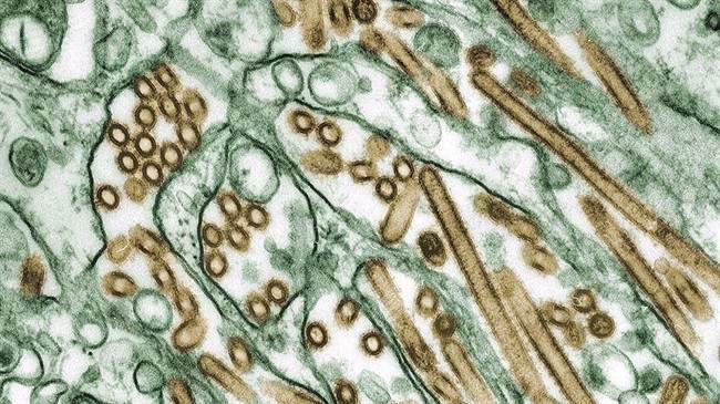A colourized transmission electron micrograph of Avian influenza A H5N1 viruses (seen in gold) are shown in this 1997 image. 
