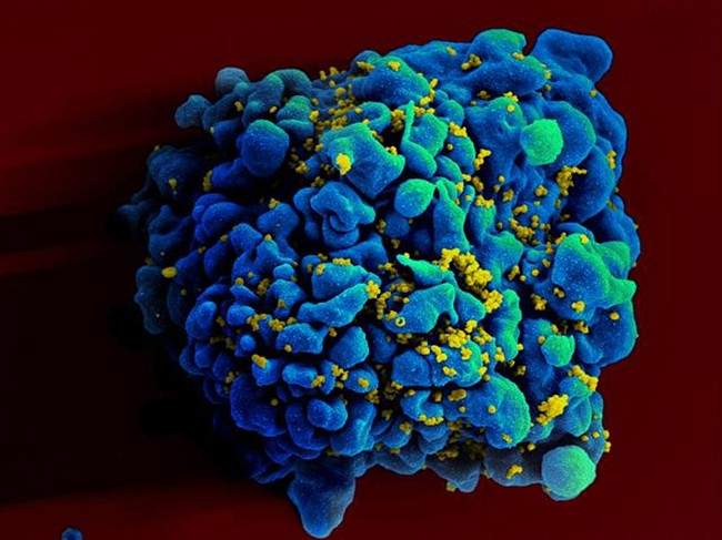 HIV-AIDS experts call for political action - image