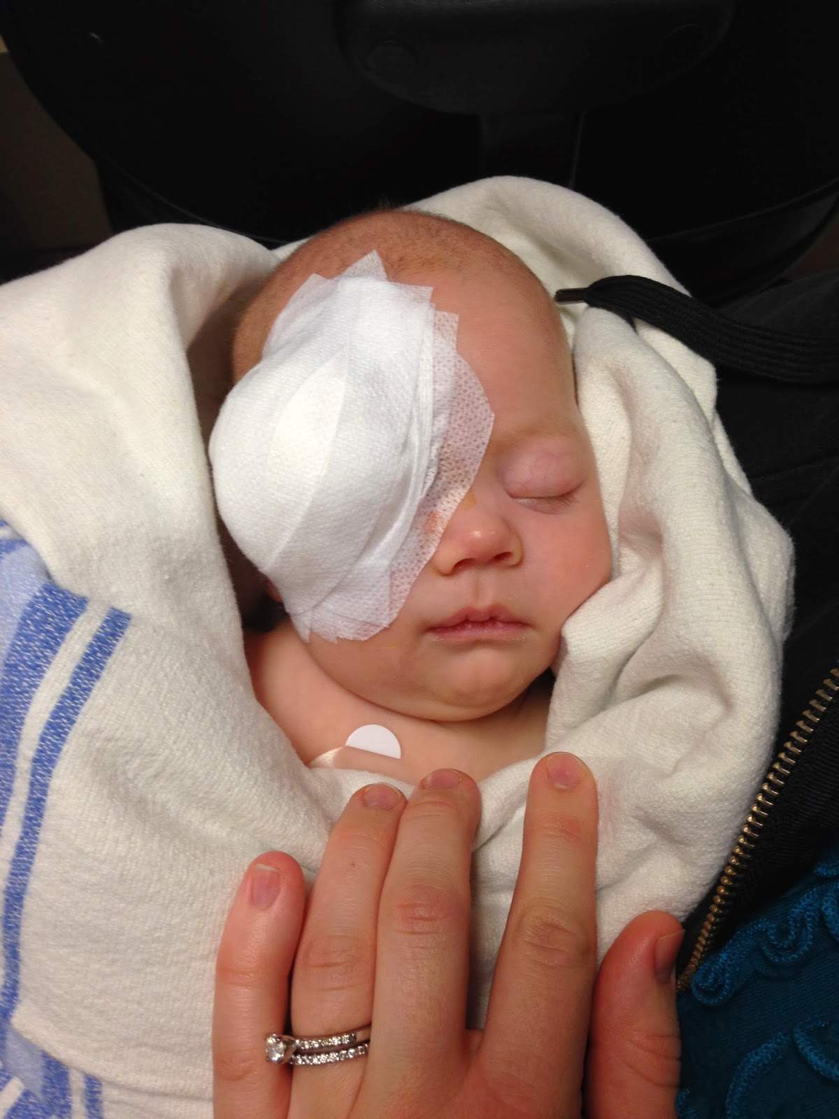 Thomas Low post surgery.