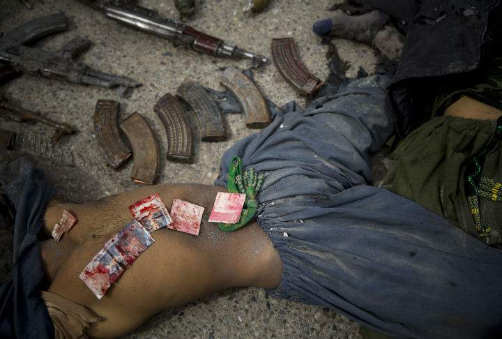 Pakistani bank notes covered in blood are displayed on the body of a dead suicide bomber after police found them in his pocket after an attack on the former Afghan intelligence headquarters, in the center of Kandahar, Afghanistan, on Mar. 12, 2014.