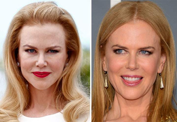 Nicole Kidman face
