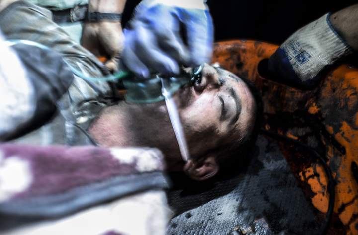 An injured miner.