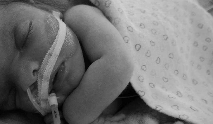 Sick Kids doctors treat baby with rare skull condition - image