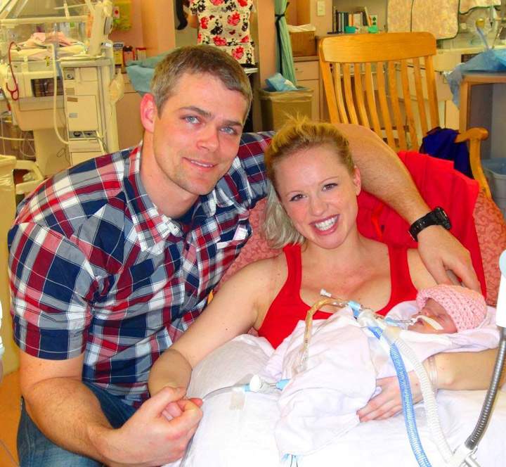Sick Kids doctors treat baby with rare skull condition - image