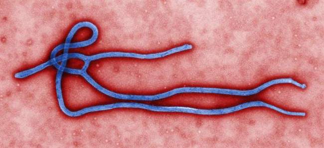 This photo provided by the CDC shows an Ebola virus. 
