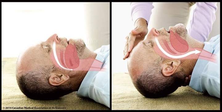 We’re doing CPR all wrong, Canadian doctor suggests - image