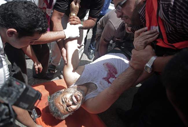 Palestinian medics place an injured man on a stretcher in the Shifa hospital after an Israeli missile strike in Gaza City on Saturday, July 12, 2014. Palestinian officials said Israeli airstrike hit a group of people sitting in front of a closed shop killing several, raising the Palestinian death toll to more than 120 during an Israeli offensive that showed no signs of slowing down. (AP Photo/Khalil Hamra)