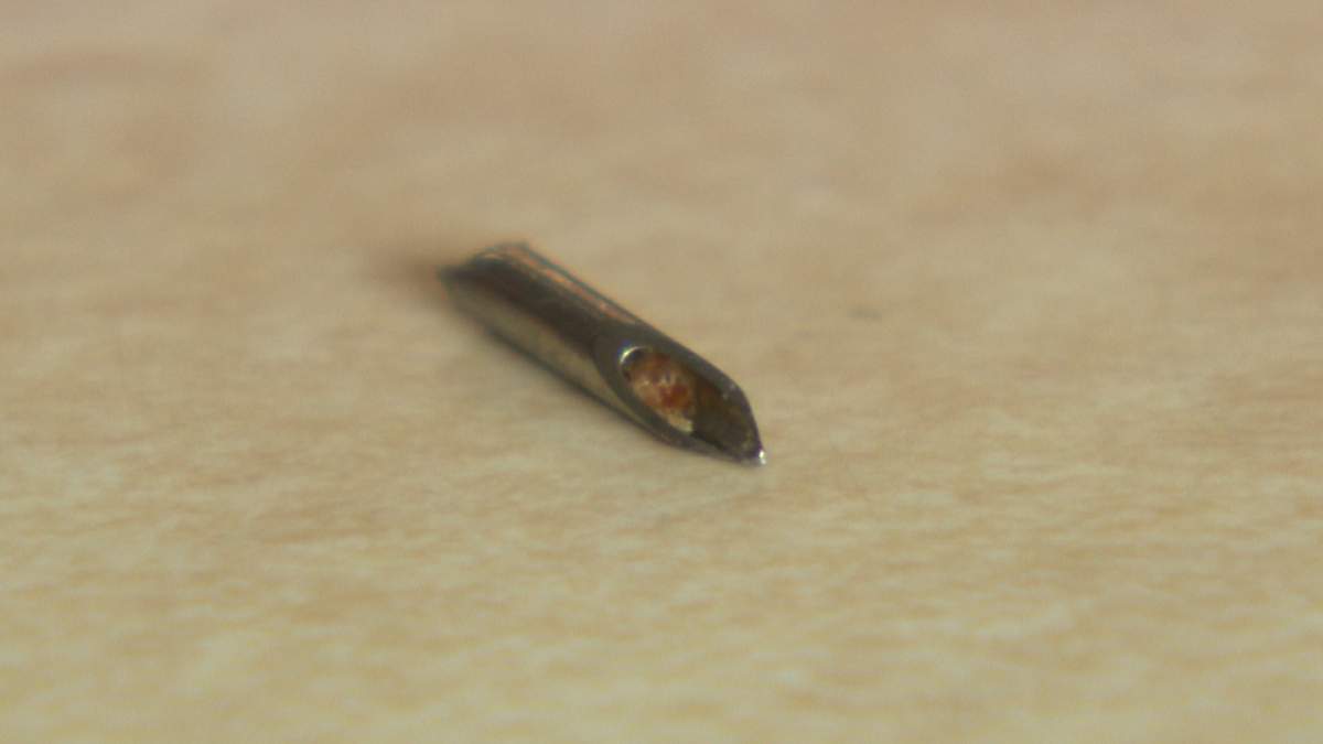 This needle was found in a Calgary boy's hamburger.