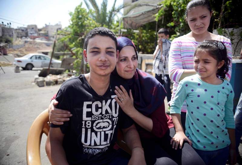 Tariq Abu Khdeir is hugged by his mother Suha after he was released from detention in Jerusalem on Sunday, July 6, 2014. (AP Photo/Mahmoud Illean).