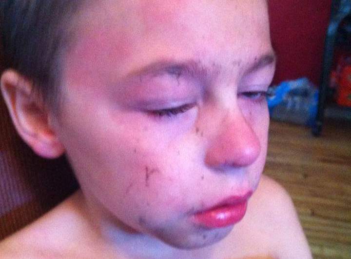Zachary told his mother at least two teenagers hit him.