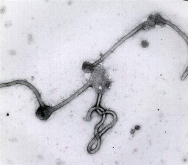 Ebola virus