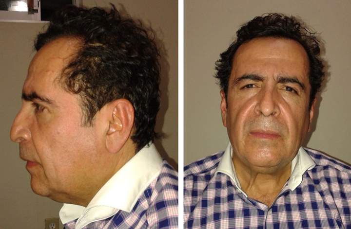Mexico says alleged cartel capo Hector Beltran Leyva captured - image