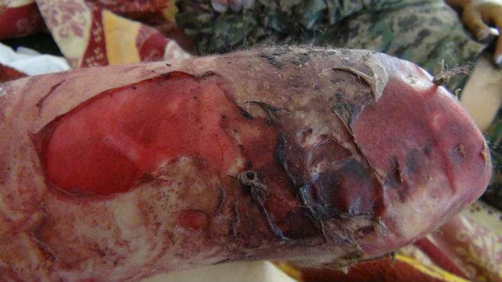 An image purportedly showing the victim of a chemical weapon attack, allegedly carried out by ISIS, near the town Kobani.