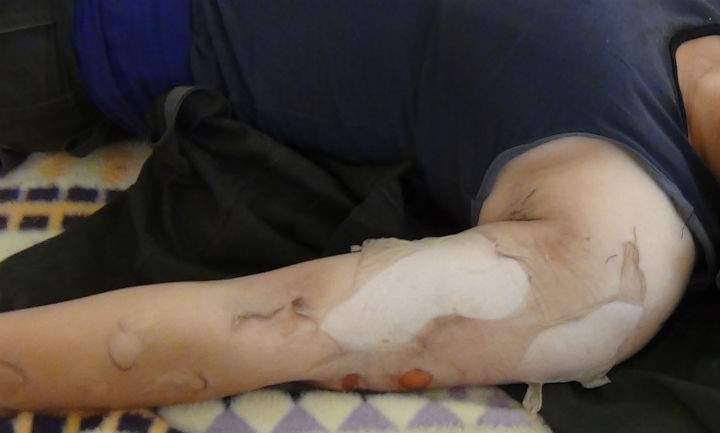 An image purportedly showing the victim of a chemical weapon attack, allegedly carried out by ISIS, near the town Kobani.