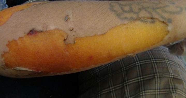An image purportedly showing the victim of a chemical weapon attack, allegedly carried out by ISIS, near the town Kobani.