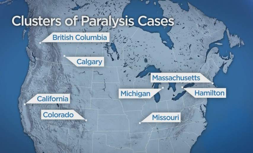 More Canadian children being tested for neurological symptoms - image