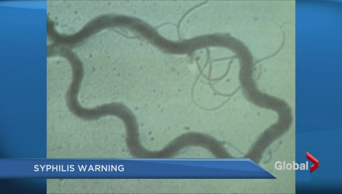 Winnipeg experiencing worst syphilis outbreak in city’s history - image