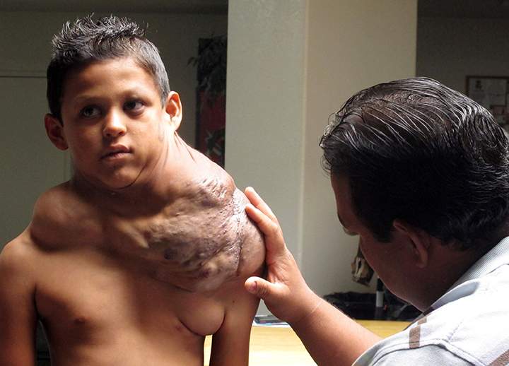 In this July 20, 2012 file photo, the father of a Ciudad Juarez-born boy suffering from a massive tumour who U.S. Homeland Security identified only as "Jose," examines his shoulder at the First Baptist Church of Rio Rancho, N.M. 