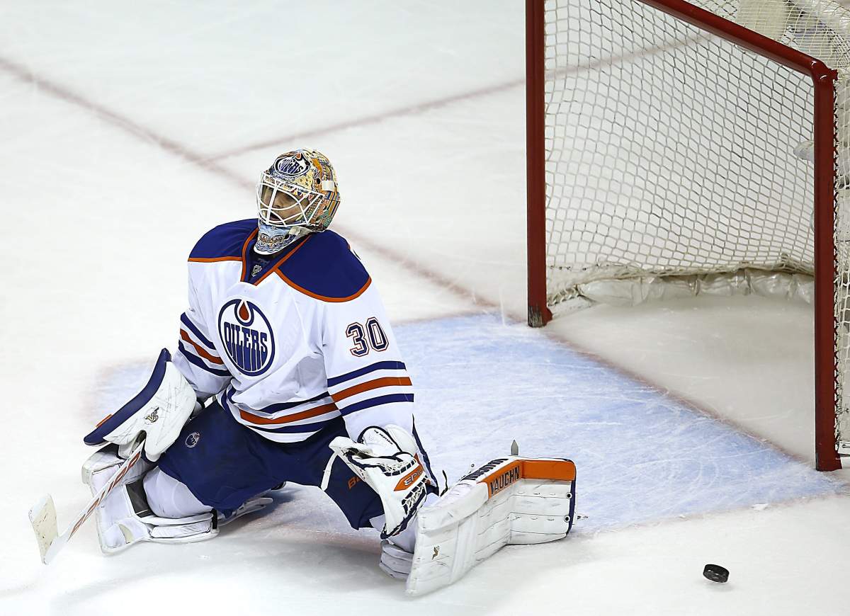 Edmonton Oilers goalie Ben Scrivens reacts after San Jose Sharks defenseman Brent Burns scored during the third period of an NHL hockey game Tuesday, Dec. 9, 2014, in San Jose, Calif. San Jose won 5-2.