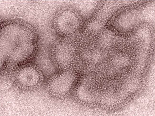 Saskatchewan influenza activity on the rise with experts urging flu vaccine - image