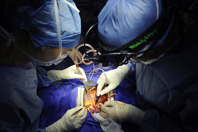 Heart surgery