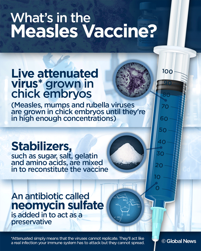 What’s in a measles vaccine? 4 things you need to know - image