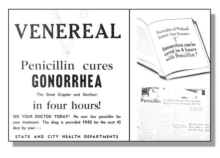 This poster was displayed during the Second World War to promote penicillin as a treatment for gonorrhea.