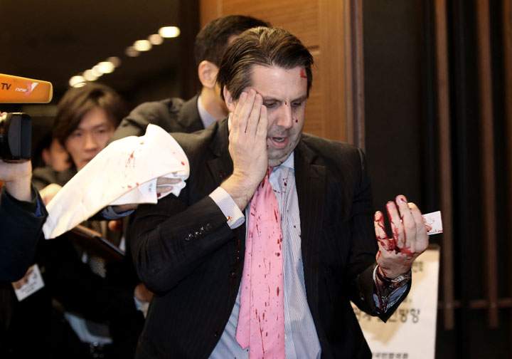 U.S. Ambassador to South Korea Mark Lippert leaves a lecture hall for a hospital in Seoul, South Korea, Thursday, March 5, 2015 after being attacked by a man.