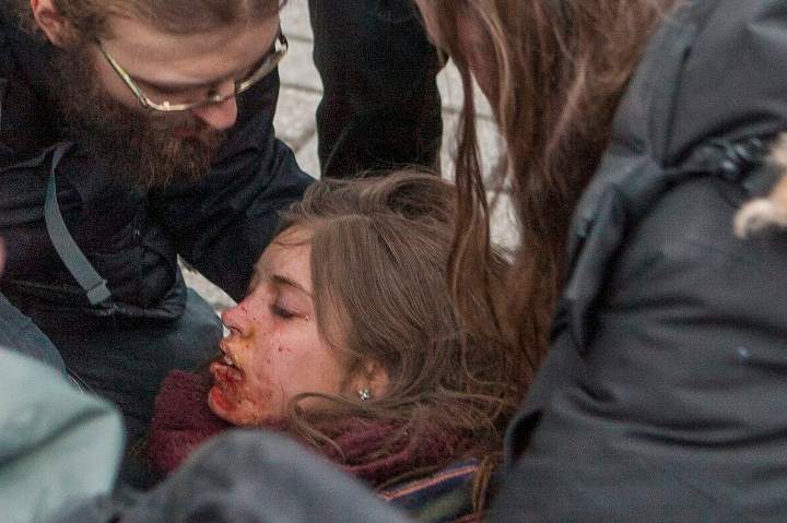 Protesters help a young woman injured after being hit at close range by tear gas shot by police during a protest against austerity organized by the ASSE student group in Quebec City, Thursday, March 26, 2015.
